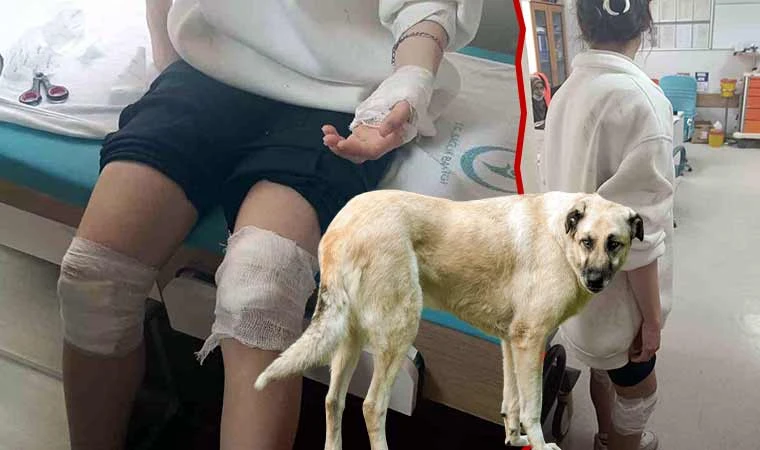 Sokak köpeklerinin saldırısına uğradı